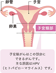 HPV（ヒト・パピローマ・ウイルス）とは？