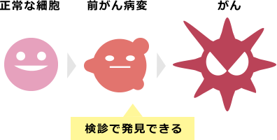 子宮頸部細胞診でがんになる前の異常も見つけられる